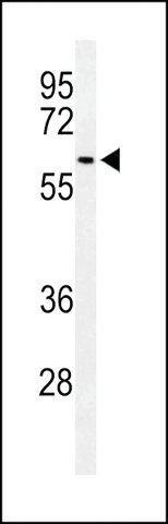 ANTI-SNX27 (CENTER) antibody produced in rabbit