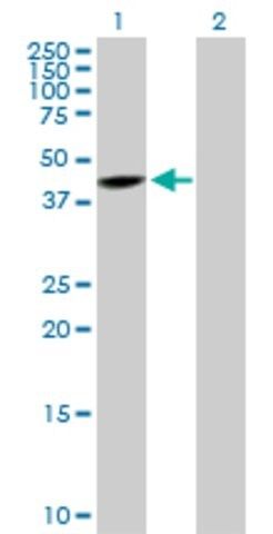 Anti-SNUPN antibody produced in rabbit