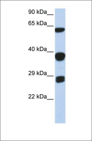 Anti-SNRPB antibody produced in rabbit