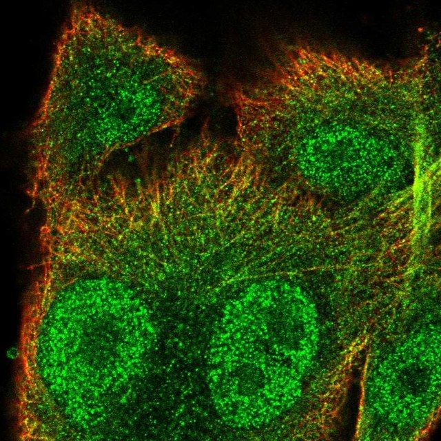 Anti-SNX10 antibody produced in rabbit