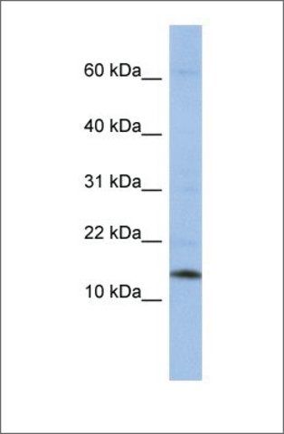 Anti-SNRPD2 antibody produced in rabbit