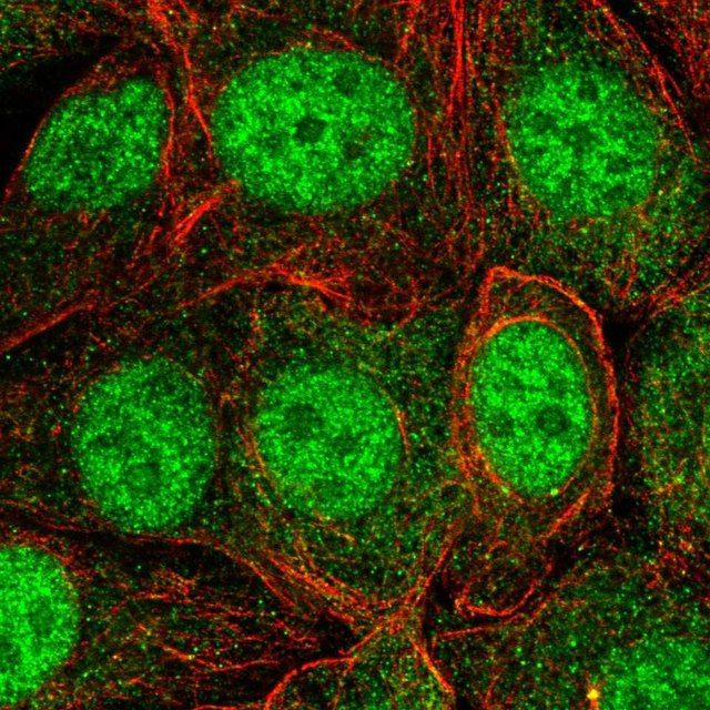 Anti-SKP1 antibody produced in rabbit