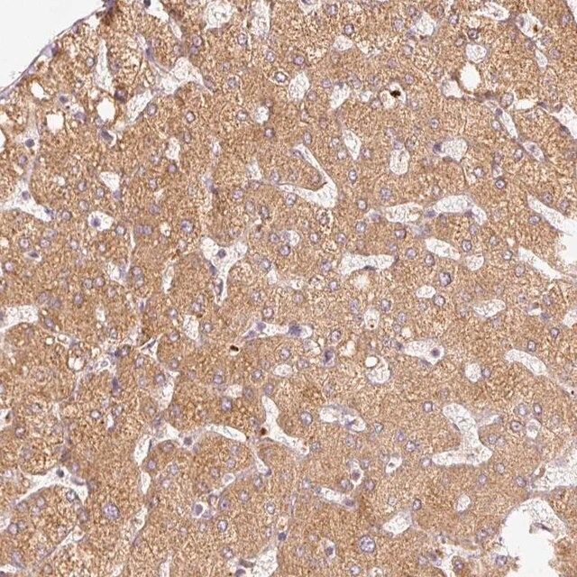 Anti-SERPING1 antibody produced in rabbit