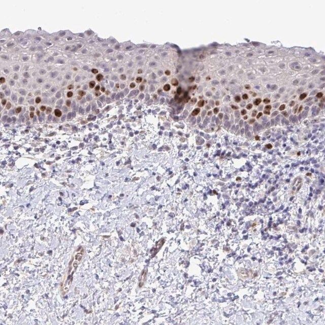 Anti-SETD7 antibody produced in rabbit