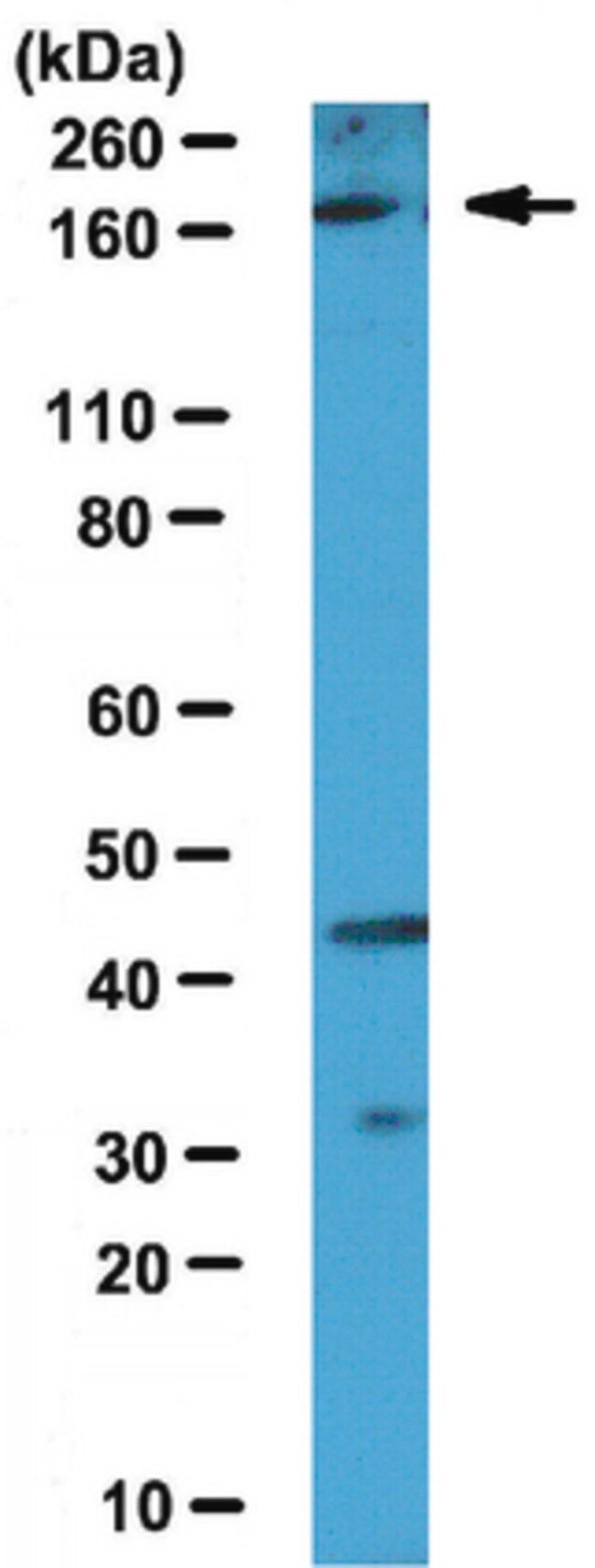 Anti-Set1A Antibody