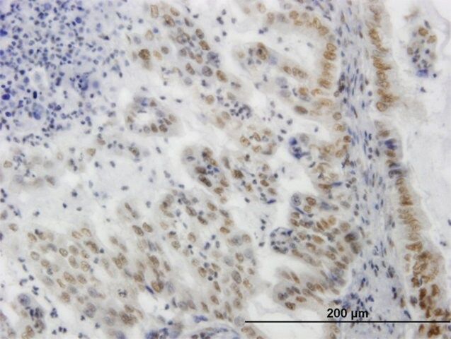 ANTI-SGK antibody produced in mouse