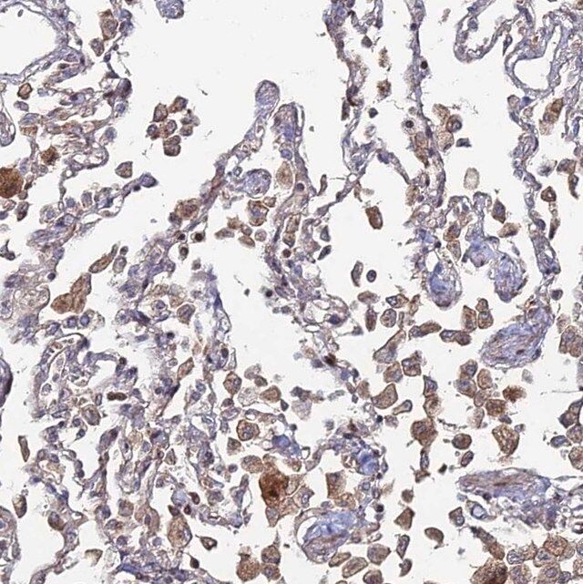 Anti-Sgms1 antibody produced in rabbit