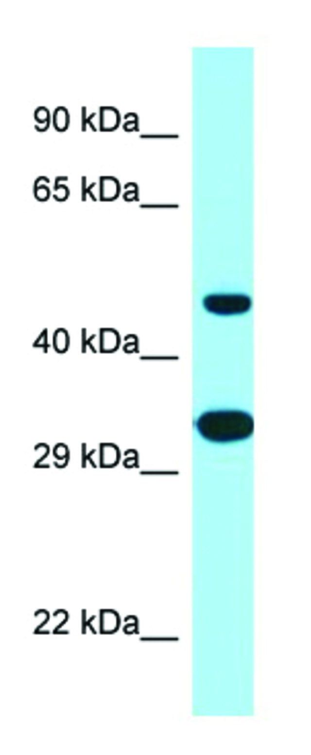 Anti-SCD5 (C-terminal) antibody produced in rabbit