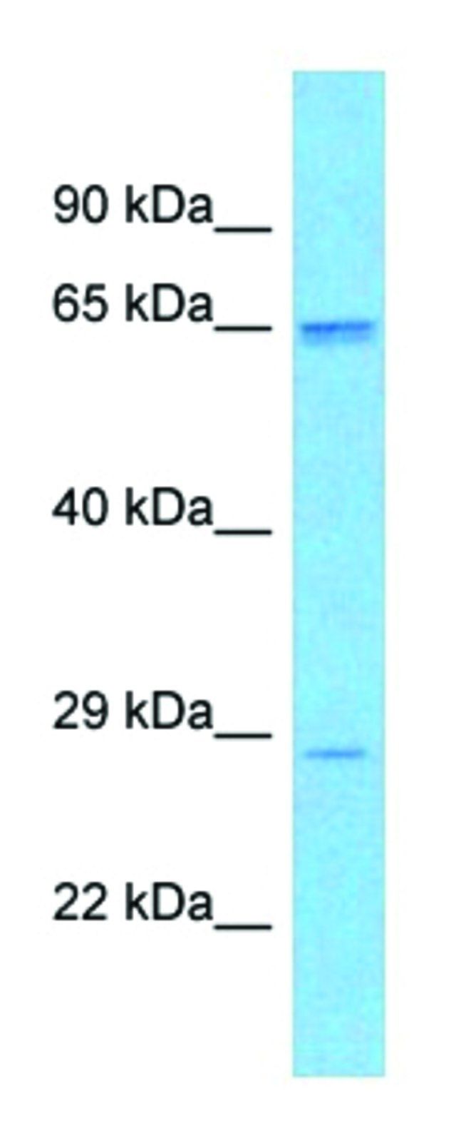Anti-SCD5 antibody produced in rabbit