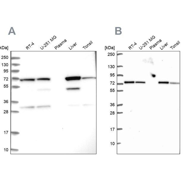 Anti-SDHA antibody produced in rabbit