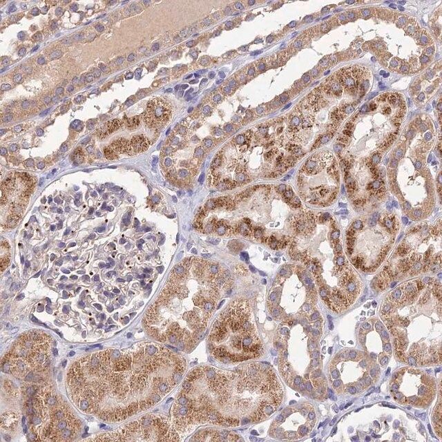 Anti-SDHD antibody produced in rabbit