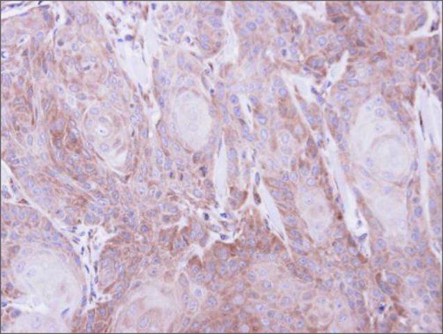 Anti-SEC61A1 antibody produced in rabbit