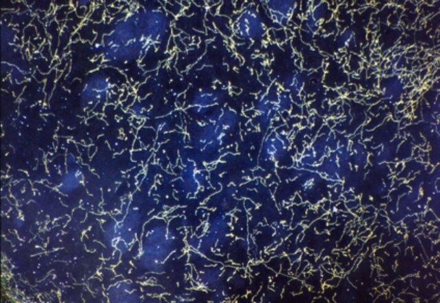Anti-Serotonin Transporter Antibody