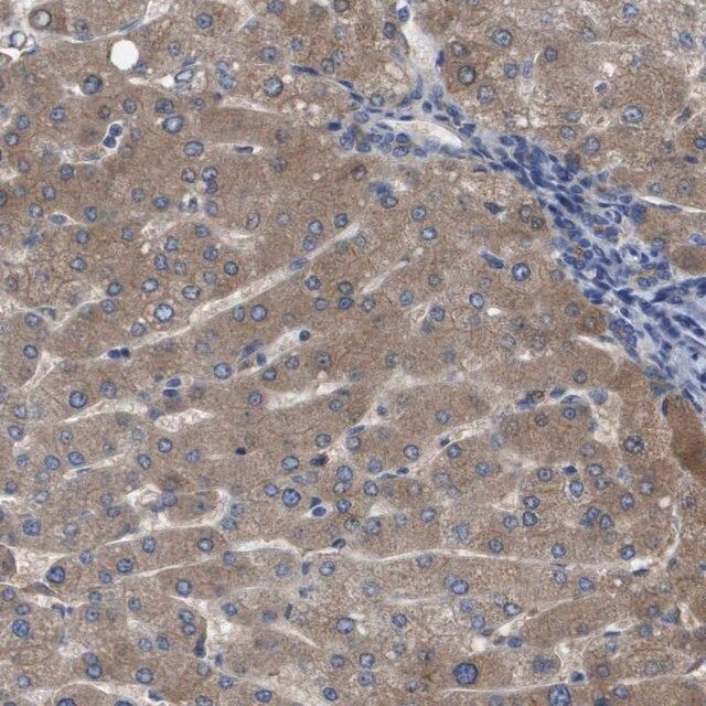 Anti-SERPINA6 antibody produced in rabbit