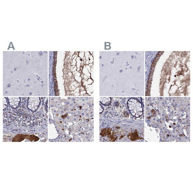 Anti-SERPINA3 antibody produced in rabbit