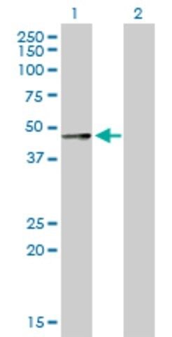 Anti-SERPINA12 antibody produced in rabbit
