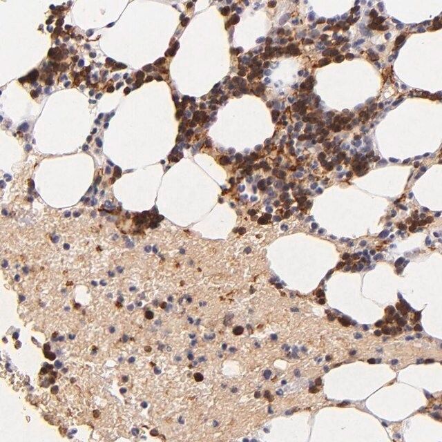 Anti-SERPINC1 antibody produced in rabbit