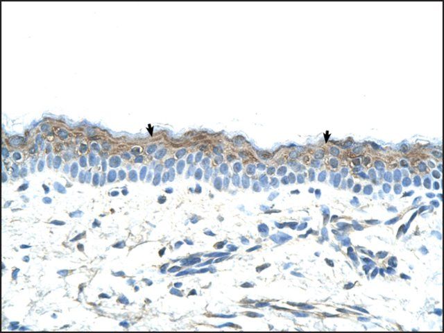 Anti-SERPINB5 antibody produced in rabbit