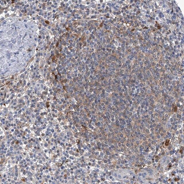 Anti-SERPINB9 antibody produced in rabbit