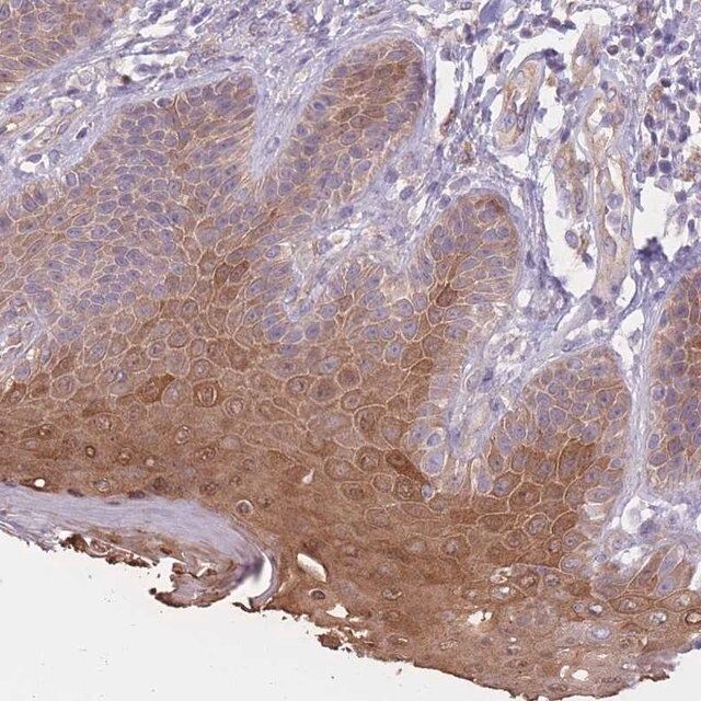 Anti-SERPINB4 antibody produced in rabbit