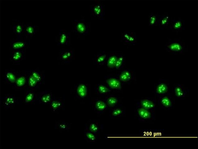 Anti-RSL1D1 antibody produced in mouse