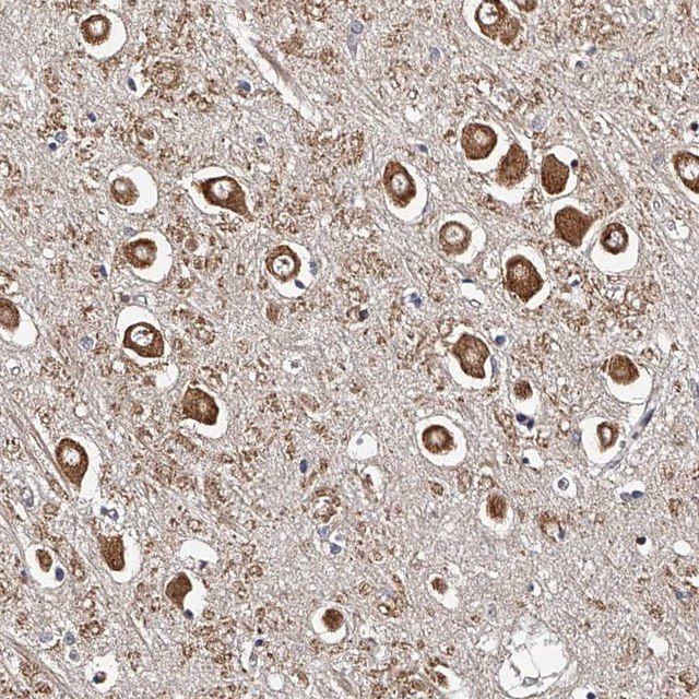 Anti-RSC1A1 antibody produced in rabbit