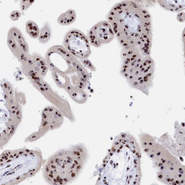 Anti-RSL1D1 antibody produced in rabbit