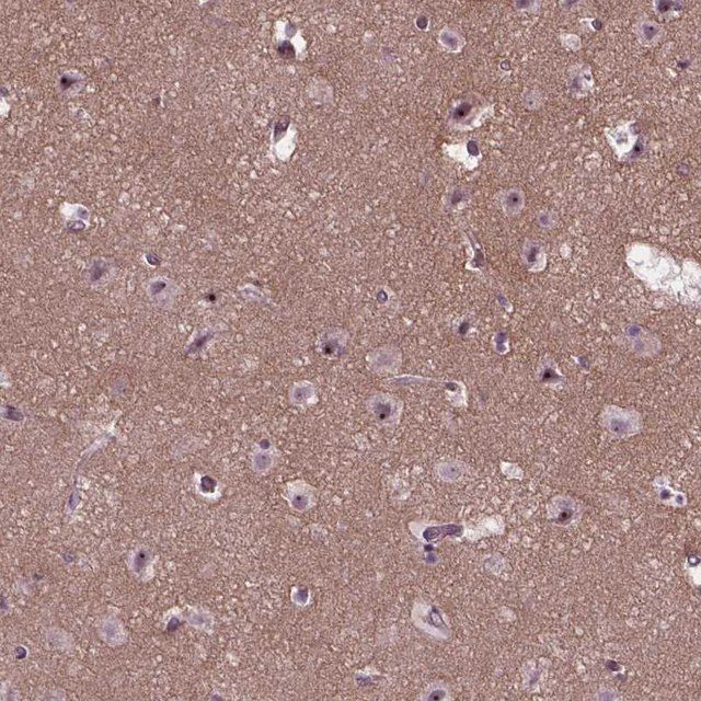 Anti-RUNX1T1 antibody produced in rabbit