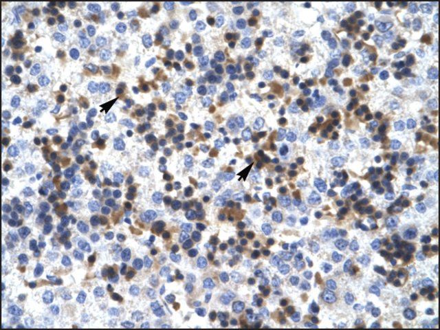 Anti-RUVBL2 antibody produced in rabbit