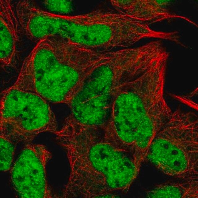Anti-RUNX1T1 antibody produced in rabbit