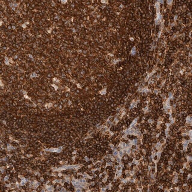 Anti-RUNDC1 antibody produced in rabbit