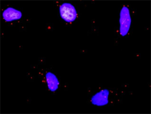 Anti-RUNX1T1 antibody produced in rabbit