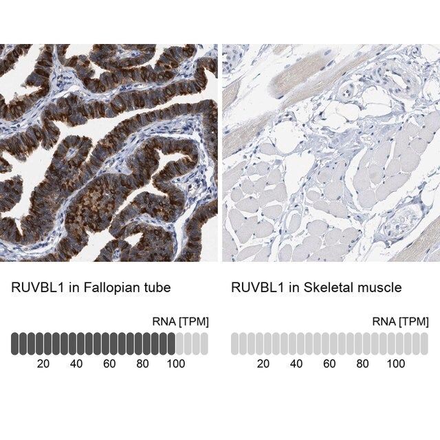 Anti-RUVBL1 antibody produced in rabbit