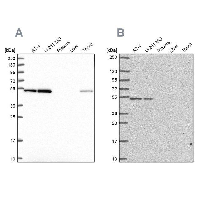Anti-RUVBL2 antibody produced in rabbit