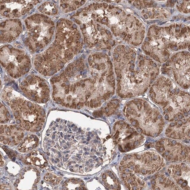 Anti-RWDD4 antibody produced in rabbit