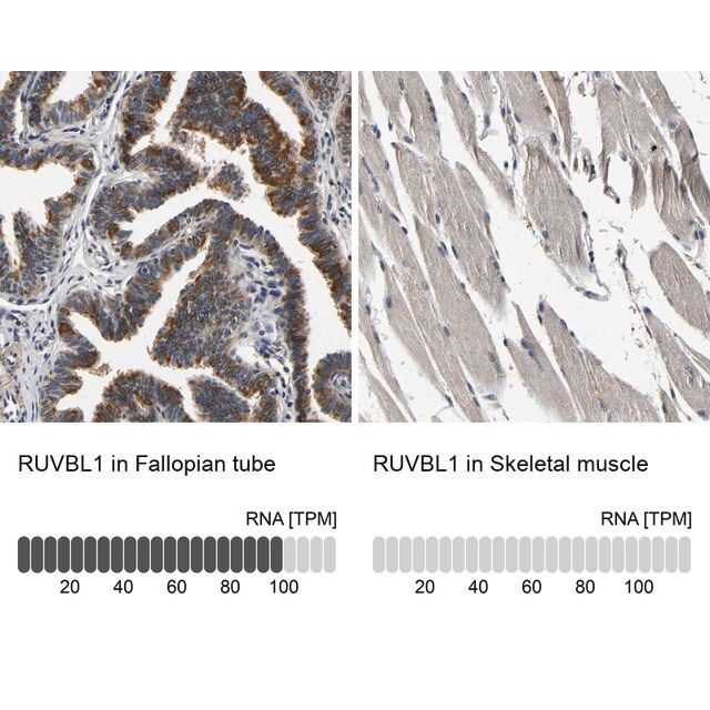 Anti-RUVBL1 antibody produced in rabbit