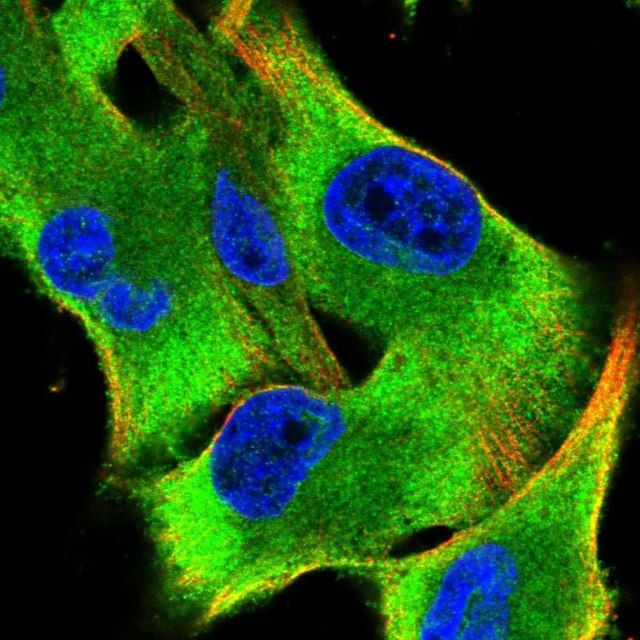 Anti-SARS antibody produced in rabbit
