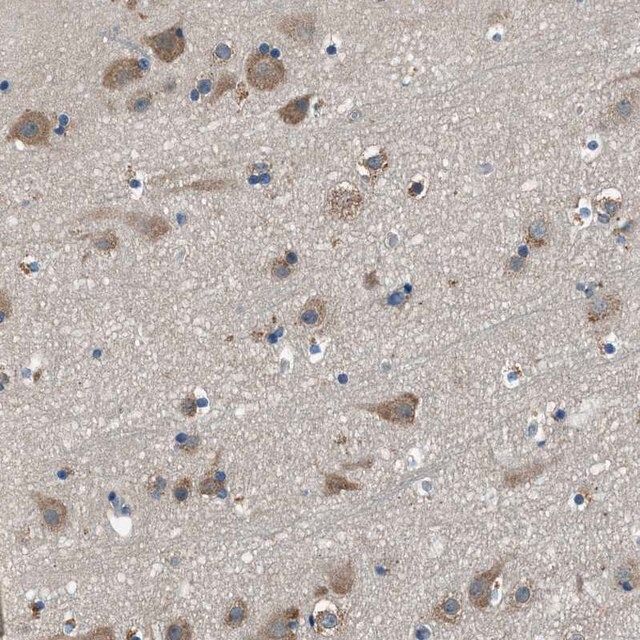Anti-SARS antibody produced in rabbit