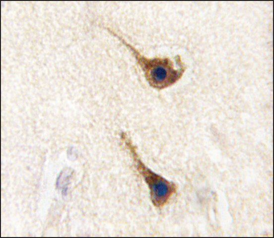 Anti-SARS2 (N-term) antibody produced in rabbit