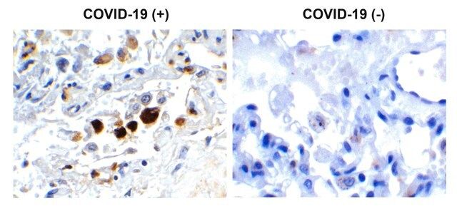 Anti-SARS-CoV-2 (COVID-19) Membrane antibody produced in rabbit