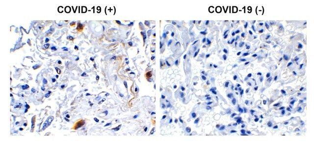 Anti-SARS-CoV-2 (COVID-19) NSP2 antibody produced in rabbit