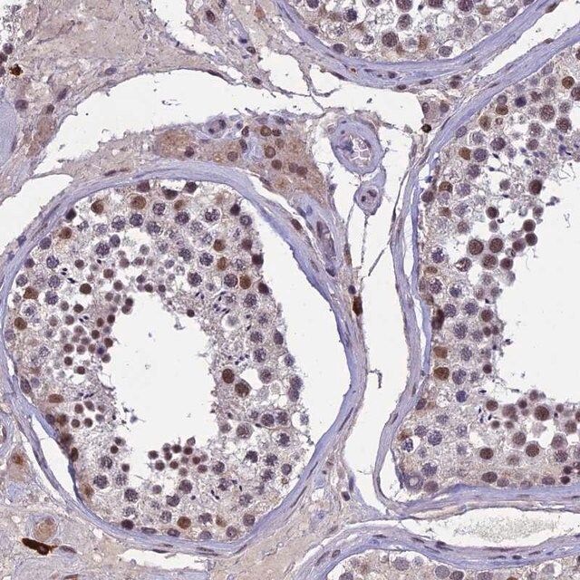 Anti-RNF40 antibody produced in rabbit