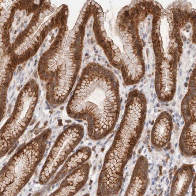 Anti-RNF213 antibody produced in rabbit