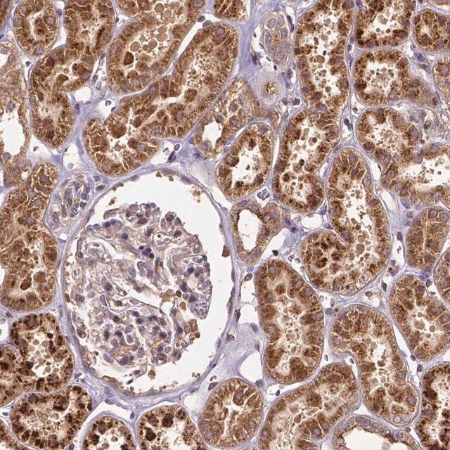 Anti-RNF123 antibody produced in rabbit