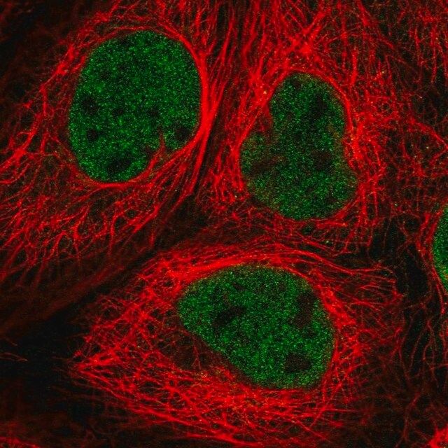 Anti-RNF20 antibody produced in rabbit
