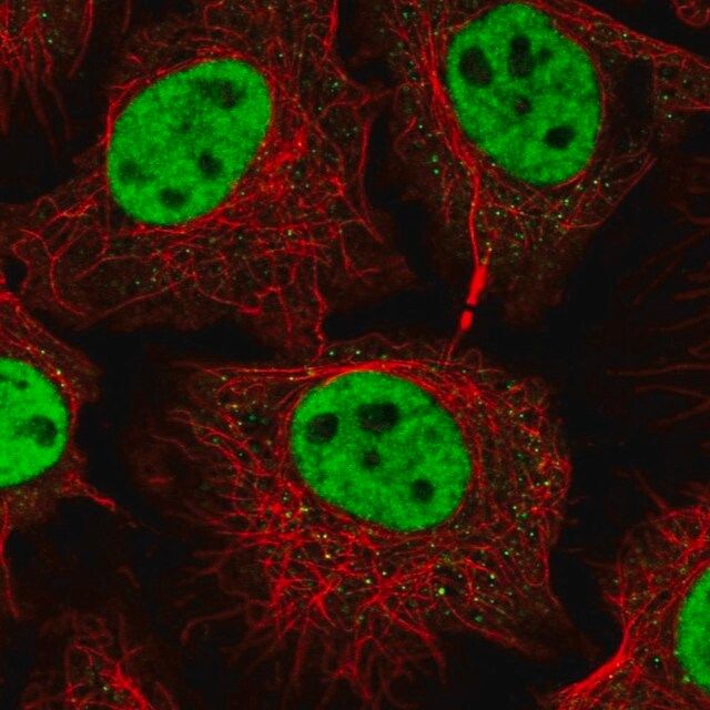 Anti-RNF40 antibody produced in rabbit