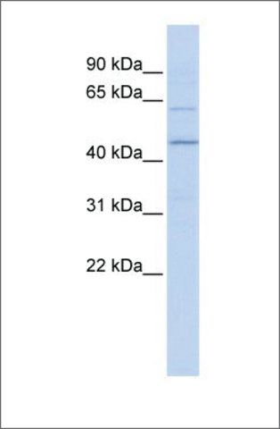 Anti-RNF13 antibody produced in rabbit