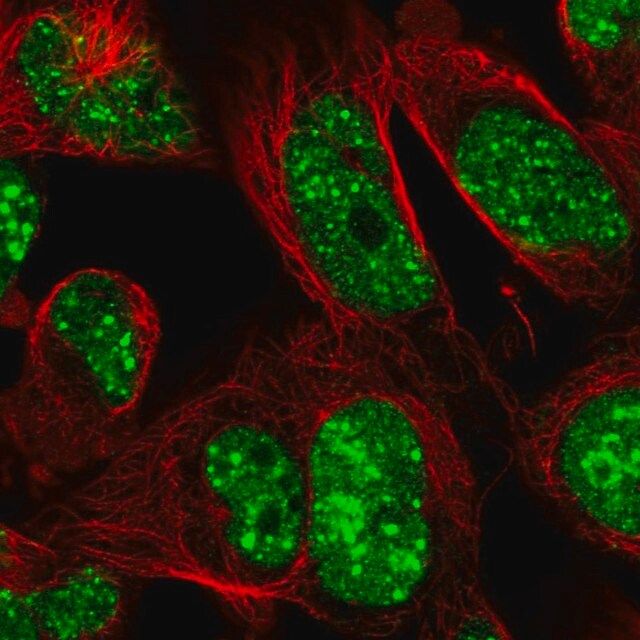 Anti-RNF169 antibody produced in rabbit