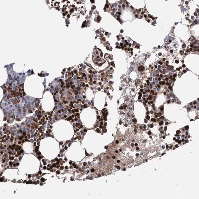 Anti-RNF6 antibody produced in rabbit
