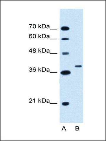 Anti-RNF146 antibody produced in rabbit